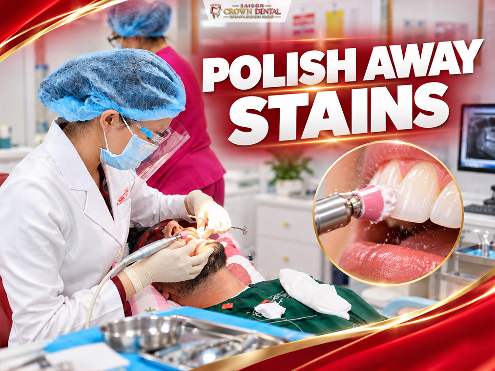 Polish Away Stains