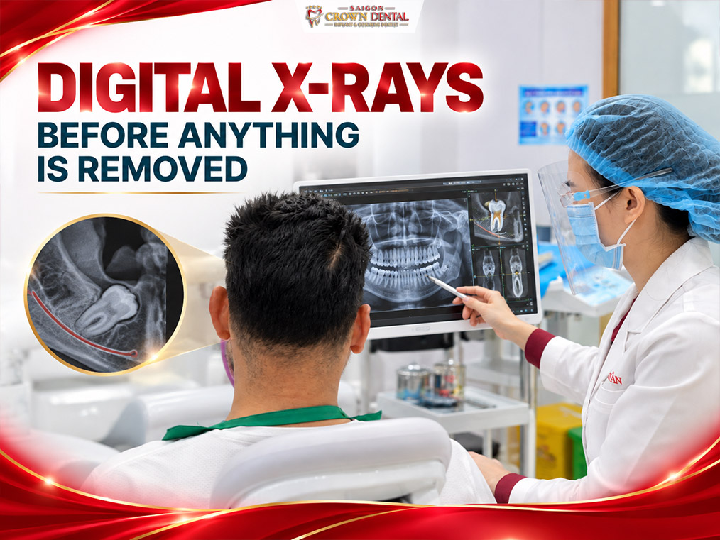 Digital X-Rays
