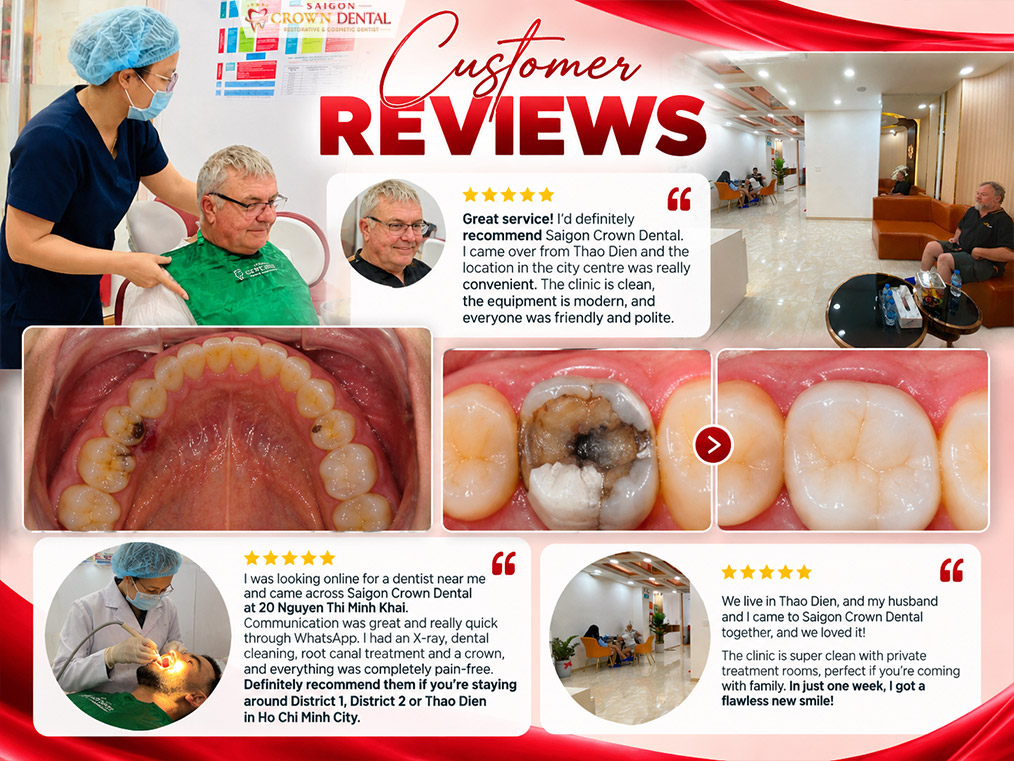 Review Dental Clinic in District 1