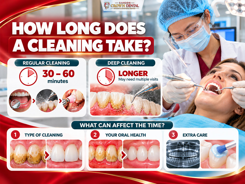 How Long Does Teeth Cleaning